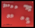 escherichia coli